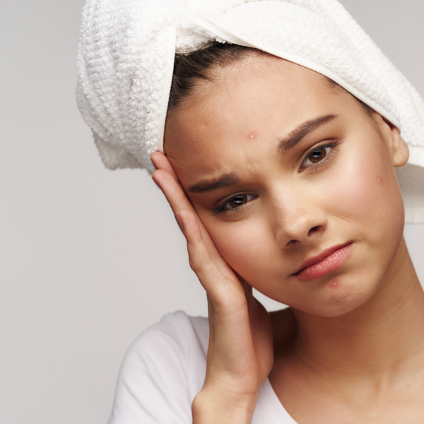 7 Steps To Healing Hormonal Acne