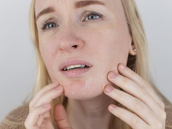 Root Causes For Dry Skin
