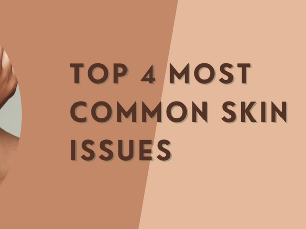 Top 4 Most Common Skin Issues